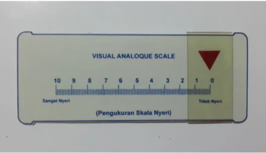 Gambar 2.10 Visual Analogue Scale  (Warden et al, 2003) 