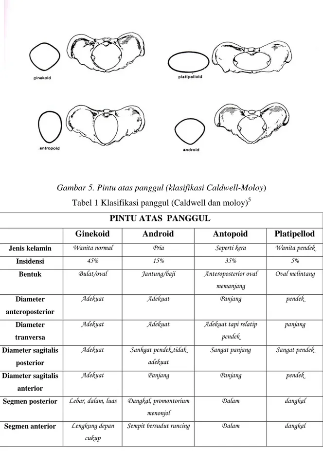 Gambar 5. Pintu atas panggul (klasifikasi Caldwell-Moloy)  Tabel 1 Klasifikasi panggul (Caldwell dan moloy) 5 