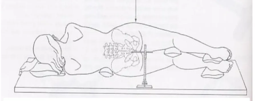 Gambar posisi proyeksi Lateral Cochler Sussman 