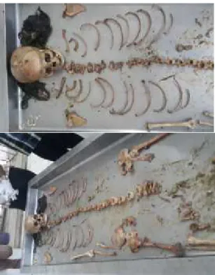 Gambar 1. Sekumpulan tulang belulang Pada  identifikasi umum  dijumpai 128  potongan  tulang  belulang  manusia yang tidak  lengkap,  setelah  dibedakan berdasarkan  penilaian  persamaan  atau perbedaan  dari  bentuk  tulang,  ukuran tulang,  warna  tulang