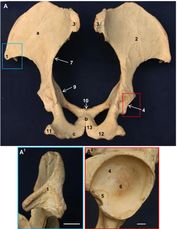 Gambar 12 Morfologi os coxae badak Sumatera tampak dorsal (A) 