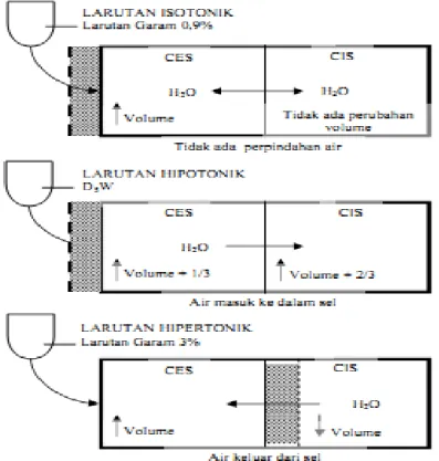 Gambar 2.3 Efek  pemberian secara intravena dari larutan   isotonik,  hipotonik, hipertonik pada  distribusi air diantara   bagian-bagian cairan tubuh