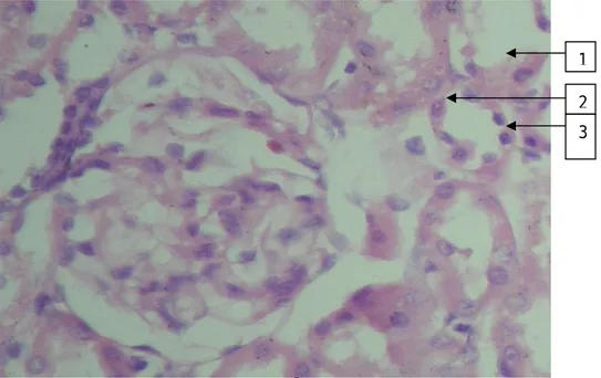 Gambar 3. Morfologi sel epitel tubulus ginjal:  no 1 normal, 2 degenerasi,  3 nekrosis 