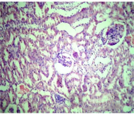 Gambar 4 : Gambaran mikroskopis ginjal tikus Rattus nurvegicus dengan pemberian tawas 4% 