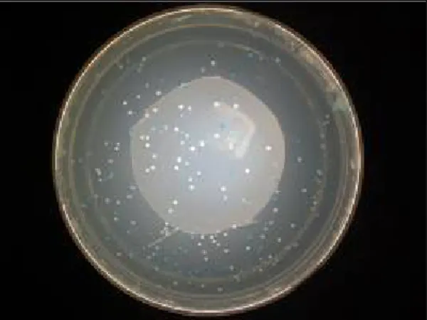 Gambar 11. Gambar Koloni Bakteri Hasil Transformasi 