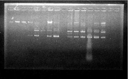 Gambar 4. Hasil elusi isolasi DNA Plasmid 