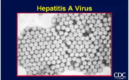Gambar 3. Gambaran mikroskopis hepatitis A ( WHO, 2000) 
