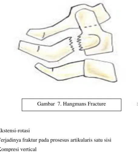 Gambar  7. Hangmans Fracture 