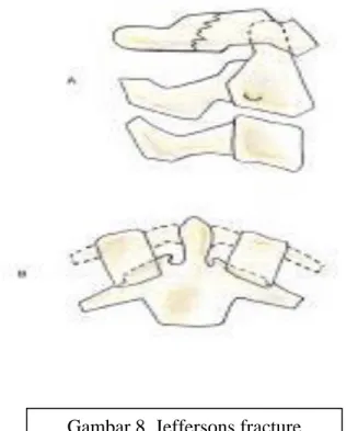 Gambar 8. Bursting fracture vertebra servical tengah &amp; bawah 