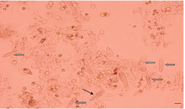 Gambar  2.   Tipe nematosit MpM  dan HI  dari S.  hystrix  dan  S. caliendrum dengan  pembesaran  400x  yang  digunakan  untuk  pengukuran  dimensi  nematosit