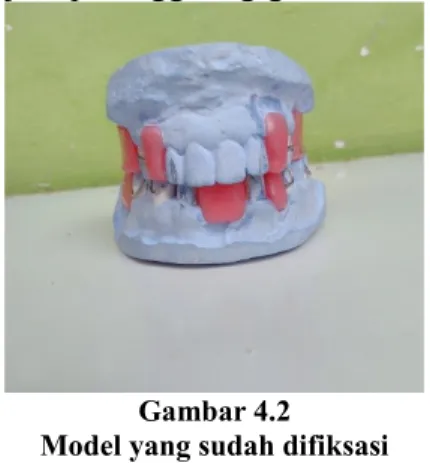 Gambar 4.2 Model yang sudah difiksasi