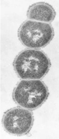 Gambar 6. Bakteri Sterptokokus  10