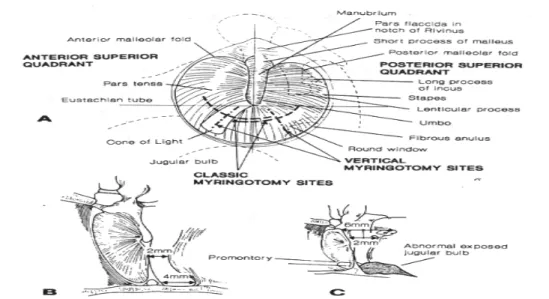 Gambar 2.2 : Membran Timpani  1,2,3