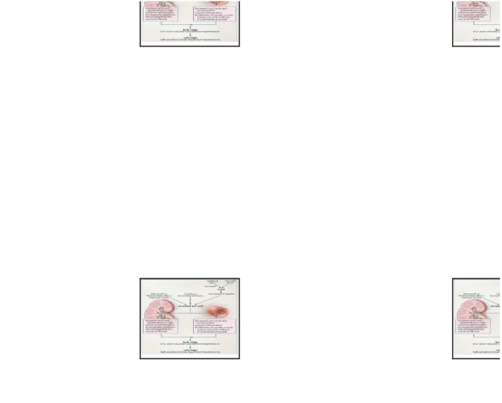 Gambar 2.4 Patofisiologi Hiperurisemia Menyebabkan Kerusakan Ginjal Dikutip dari : Watanabe dk k  28