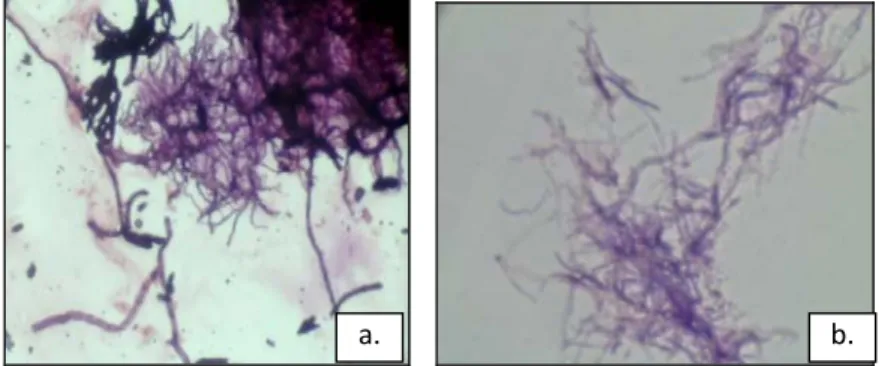 Gambar 1. Hasil pewarnaan gram isolat Actinomycetes 