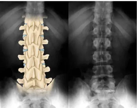 Foto X-ray dilakukan pada posisi anteroposterior (AP ), lateral, dan bila perlu oblique  kanan dan kiri