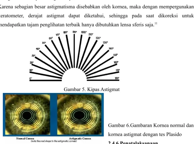 Gambar 5. Kipas Astigmat   