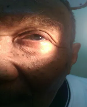 Gambar Oculi Dextra  Gambar Oculi Sinistra 