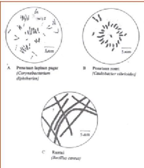 Gambar 2. Penataan bentuk bakteri batang: (a) pagar, (b) roset dan (c) rantai. 