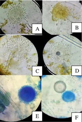 Gambar   3.   Penampakan koloni dari spesies (A)  F20A  (B).  F138  (C).  F80CB  dan   (D)