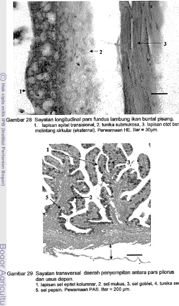 Gambar 29 Sayatan transversal daerah penyempitan antara pars pilorus 