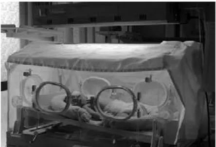 Gambar 1. Kain satin putih yang diletakkan mengelilingi inkubator bayi