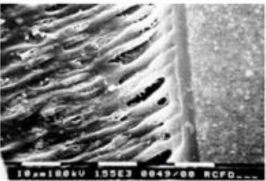 Gambar 2. Hybrid layer yang terbentuk (pemindaian mikroskop elektron x 1.550)  (Apriyono, 2010)