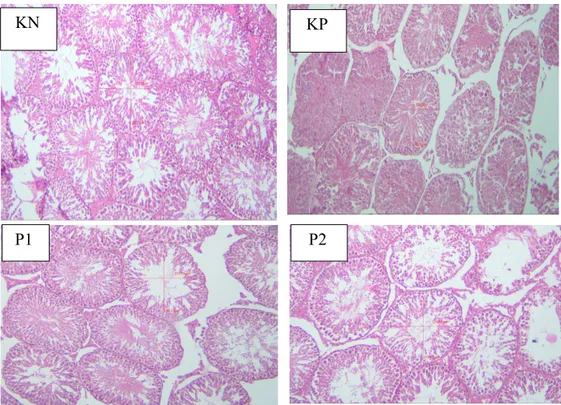 Gambar 1 Fotomikrograf histopatologis testis tikus putih strain Wistar pada kontrol Negatif (KN),   Kontrol  Positif  (KP),  Perlakuan  1  (P1)  dan  Perlakuan  2  (P2)  dengan  pewarnaan  HE  dan  pembesaran 40x