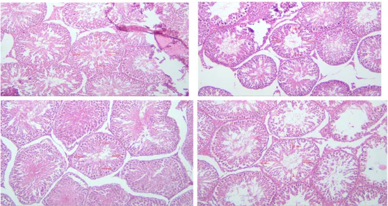 Gambar  2.  Fotomikrograf  histomorfometri  ketebalan  epitel  tubulus  seminiferus  testis  tikus  putih  strain  Wistar pada Perlakuan Kontrol Negatif (KN), Kontrol Positif (KP),   Perlakuan Vit