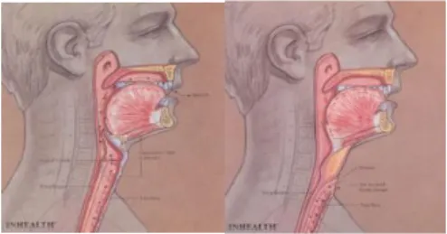 Fig. 1a. Before the larynx removed  [3] 