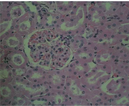 Gambar 9 Apoptosis epitel tubuli kontorti ginjal yang ditandai dengan inti piknotis (panah putih) H&amp;E.