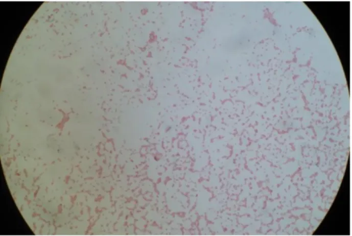 Gambar 1 Klebsiella pneumoniae (Wulandari, 2013) 