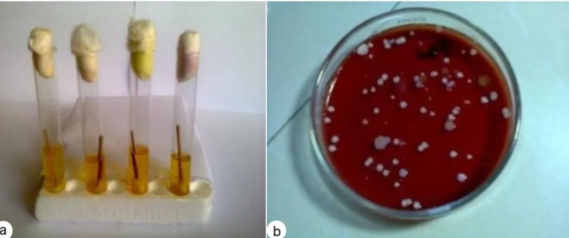 Gambar 1. Isolat bakteri yang diisolasi dari ruang UGD. a. isolat berasal dari  alat kesehatan, dan b
