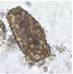 Gambar 2.2. Telur Ascaris lumbricoides yang Tidak Dibuahi (unfertilized)  Sumber : http://www.cdc.gov/parasites/ascariasis/index.html 