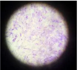Gambar  7. Hasil uji Bakteri Staphylococcus aureus pada Manitol Salt Agar 