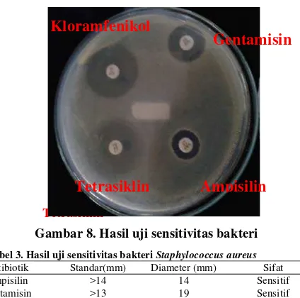 Gambar 8. Hasil uji sensitivitas bakteri 