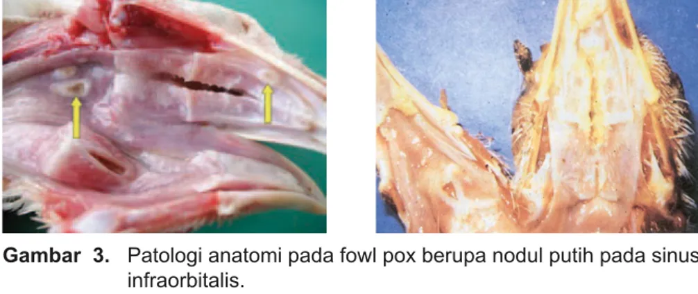 Gambar  3.   Patologi anatomi pada fowl pox berupa nodul putih pada sinus  infraorbitalis.