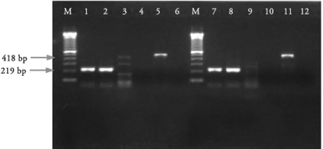 Gambar 8. Hasil amplifikasi setelah infeksi selama 36  dan 48 jam  pada sel MDCK yang diinfeksi virus  BwiI2/10,  dengan keterangan sebagai berikut: M  adalah Marker (Molecular weight, 100 bp),  1) Beta  actin, infeksi 36 jam, 2) Beta actin, kontrol sel 36