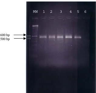 Gambar 3  Hasil amplifikasi dengan primer H5 avian influenza. 