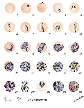 Gambar 6  Berbagai bentuk sel darah merah yang terserang Plasmodium  (CDC 2011) 