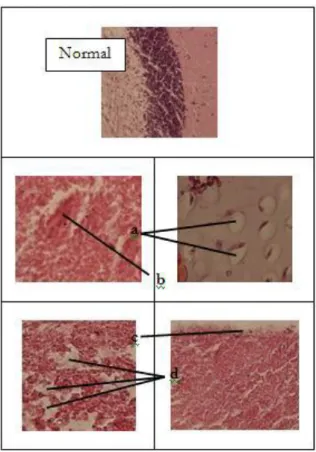 Gambar  6.  di  bawah  ini,  dimana  terjadi  keadaan  abnormal  berupa  hipertropi,  kongesti, hemoragge, dan vakuolisasi