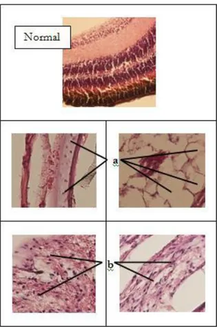 Gambar  7.  Histopatologi  mata  Kerapu  Tikus  (Cromileptes  altivelis)  yang  terinfeksi  VNN  (Viral  Nervous  Necrosis)  dengan  pewarnaan  hematoksilin  dan  eosin  yang  dilihat  menggunakan  mikroskop  cahaya  perbesaran  400x