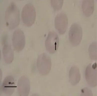 Gambar    12     Gambaran  mikroskopis Theileria  sp. berdasarkan  hasil  pengamatan 