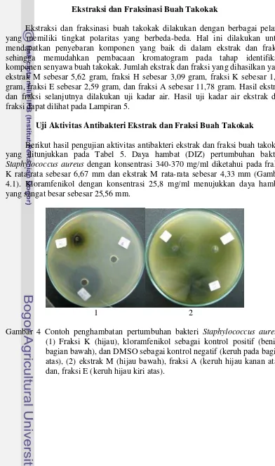 Gambar 4 Contoh penghambatan pertumbuhan bakteri Staphylococcus aureus,  