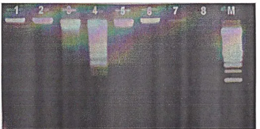 Gambar  2. Visualisasi  K ua l i t as  DNA pada gel  agarosa metode elektroforesis  horizontal