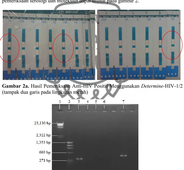 Gambar 2b. Hasil Pemeriksaan Nested PCR HIV-int (1: Lambda/Hind III Marker; 2: 