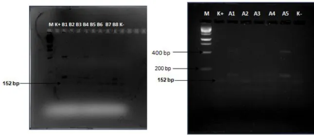 Gambar 7 menunjukkan semua sampel teramplifikasi dengan baik oleh primer gen leptin pada  ukuran  152  bp  namun  intensitas  pita  DNA  lebih  rendah  dibandingkan  dengan  penelitian  sebelumnya