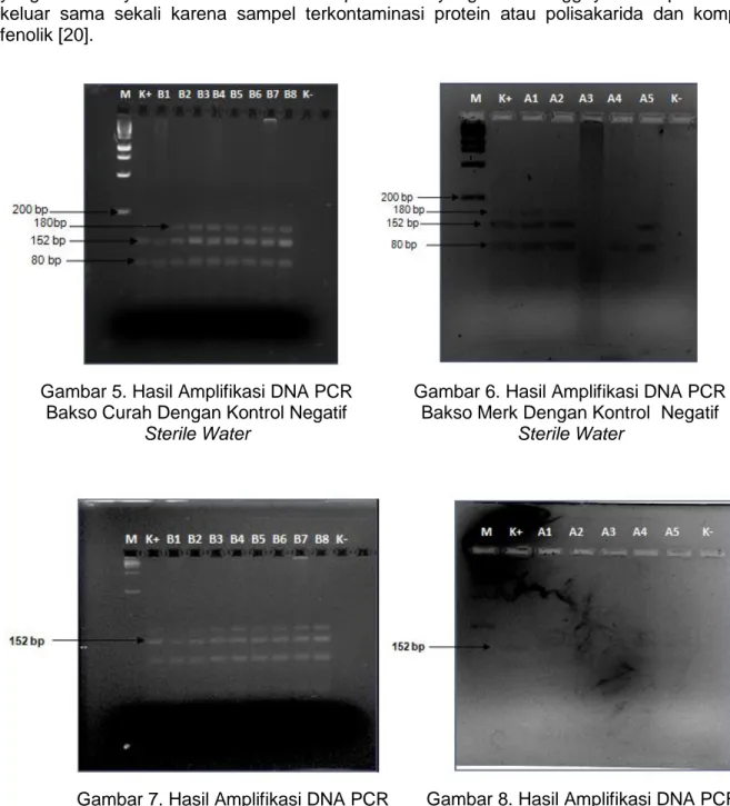 Gambar 5. Hasil Amplifikasi DNA PCR  Bakso Curah Dengan Kontrol Negatif 