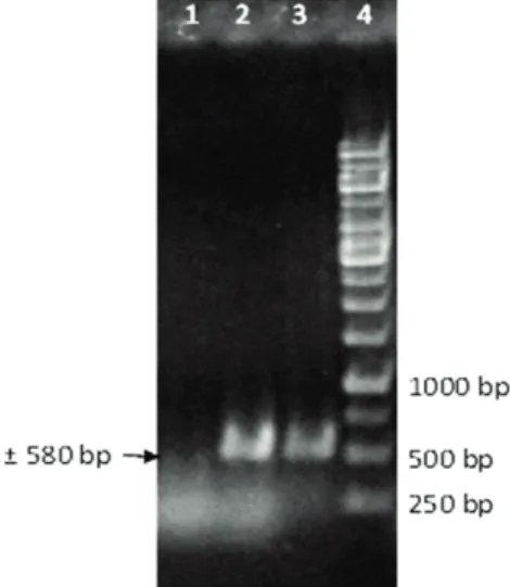 Gambar 2. Hasil identifikasi virus pada tanaman melon bergejala daun keriting dengan PCR, divisualisasi dengan gel agarose 1% (lajur 1: sampel tidak bergejala daun keriting (kontrol negatif); lajur 2: