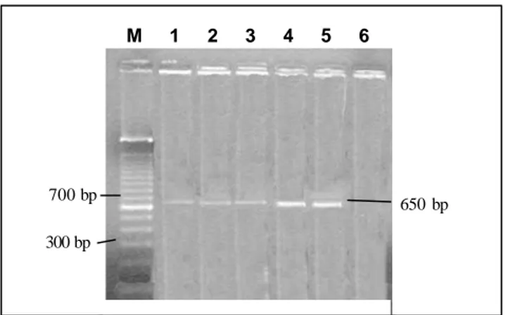 Gambar 2  Hasil visualisasi pita DNA PYMV pada agarose gel 1,5% TBE;  